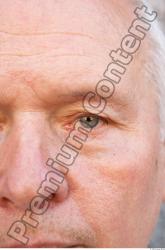 Eye Man White Average Bald
